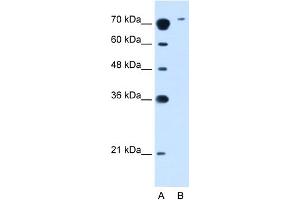WB Suggested Anti-SLC7A14 Antibody Titration:  2. (SLC7A14 抗体  (N-Term))