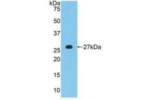 Detection of Recombinant MPZ, Human using Polyclonal Antibody to Protein Zero, Myelin (MPZ) (MPZ 抗体  (AA 30-248))