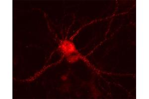 Indirect immunostaining of PFA fixed rat hippocampus neurons (dilution 1 : 500). (UNC13A/Munc13-1 抗体  (AA 3-317))