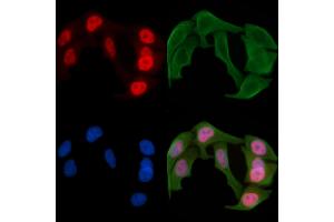 ABIN6256110 and ABIN6267388 staining Hela cells(30 min of UV treatment) by IF/ICC.