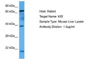 Host: Mouse Target Name: KLF2 Sample Tissue: Mouse Liver Antibody Dilution: 1ug/ml (KLF2 抗体  (N-Term))
