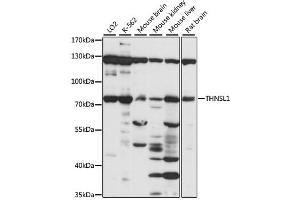 Western blot analysis of extracts of various cell lines, using THNSL1 antibody (ABIN6293622) at 1:1000 dilution. (THNSL1 抗体)