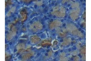 Detection of CTRC in Rat Pancreas Tissue using Polyclonal Antibody to Chymotrypsin C (CTRC) (Elastase 4 抗体  (AA 30-268))