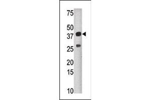 Western blot analysis of anti-SULT1C2 Pab (ABIN389140 and ABIN2839315) in mouse liver tissue lysate (35 μg/lane).