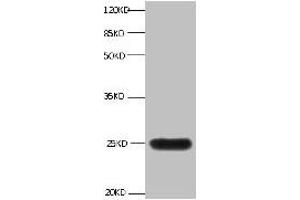 All lanes:Mouse anti-human Neutrophil gelatinase-associated lipocalin monoclonal antibody at 1 μg/mL Lane 1:NGAL transfected 293 cell lysate Predicted band size : 22 kDa Observed band size : 25 kDa (Lipocalin 2 抗体)