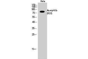 Western Blotting (WB) image for anti-Ubiquitin (Ubiquitin) (acLys33) antibody (ABIN3181498) (Ubiquitin 抗体  (acLys33))