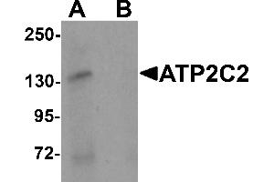 Western blot analysis of ATP2C2 in 3T3 cell lysate with ATP2C2 antibody at 1 µg/mL in (A) the absence and (B) the presence of blocking peptide (ATP2C2 抗体  (N-Term))