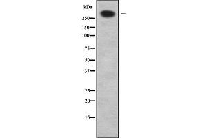 Western blot analysis of ABCA12 using LOVO whole cell lysates (ABCA12 抗体  (C-Term))