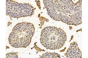 ABIN7095984 and ABIN7100046 at 1/100 staining mouse testis tissue by IHC-P. (BCL2-Like 15 抗体)