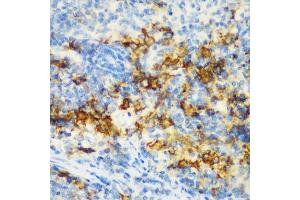 Immunohistochemistry of paraffin-embedded rat spleen using CD3D antibody (ABIN3021813, ABIN3021814, ABIN3021815 and ABIN6215992) at dilution of 1:200 (40x lens). (CD3D 抗体  (AA 22-105))