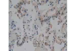 Used in DAB staining on fromalin fixed paraffin- embedded lung tissue (CENPJ 抗体  (AA 1-207))