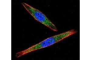 Confocal immunofluorescent analysis of LCK antibody with A2058 cells followed by Alexa Fluor 488-conjugated goat anti-rabbit lgG (green). (LCK 抗体  (AA 23-52))