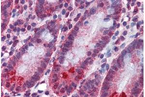 Immunohistochemistry (Formalin-fixed Paraffin-embedded Sections) (IHC (fp)) image for anti-SplA/ryanodine Receptor Domain and SOCS Box Containing 2 (SPSB2) (AA 1-91) antibody (ABIN574466)