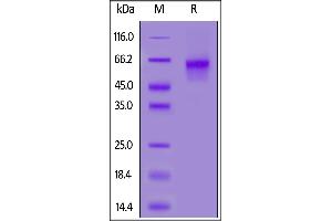 Biotinylated Mouse IL-6 R alpha, His,Avitag on  under reducing (R) condition. (IL6RA Protein (AA 20-357) (His tag,AVI tag,Biotin))