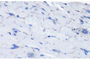 Immunohistochemistry of paraffin-embedded Mouse heart using Phospho-P70 S6K(T389) Polyclonal Antibody at dilution of 1:100 (40x lens). (RPS6KB1 抗体  (pThr389))