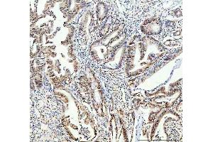 IHC analysis of FTO using anti-FTO antibody (ABIN7601059). (FTO 抗体  (AA 279-505))