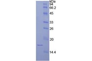 SDS-PAGE analysis of Human Laminin alpha 1 Protein. (Laminin alpha 1 蛋白)