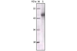 Western blot analysis using CK mouse mAb against truncated CK5 recombinant protein. (Cytokeratin 1 抗体)