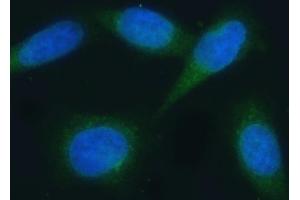 IF analysis of VAPA using anti-VAPA antibody (ABIN7603249). (VAPA 抗体  (N-Term))