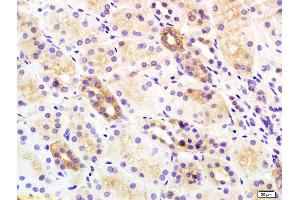 Formalin-fixed and paraffin embedded rat kidney labeled with Rabbit Anti Insulin Receptor Beta Polyclonal Antibody, Unconjugated (ABIN727340) at 1:200 followed by conjugation to the secondary antibody and DAB staining (ISR-beta 抗体  (AA 1001-1100))