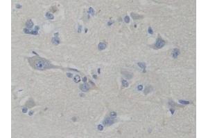 Immunohistochemistry (IHC) image for anti-phosphofructokinase, Platelet (PFKP) (AA 553-753) antibody (ABIN7434014)