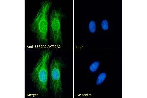 Immunofluorescence (IF) image for anti-ATPase, Ca++ Transporting, Cardiac Muscle, Slow Twitch 2 (ATP2A2) (Internal Region) antibody (ABIN1686784)