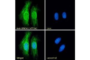 (ABIN1686784) mmunofluorescence analysis of paraformaldehyde fixed HeLa cells, permeabilized with 0. (ATP2A2 抗体  (Internal Region))