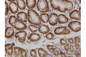 Image no. 2 for anti-P21-Activated Kinase 1 (PAK1) (AA 191-280) antibody (ABIN598852) (PAK1 抗体  (AA 191-280))