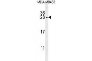 Western Blotting (WB) image for anti-Chorionic Somatomammotropin Hormone 1 (Placental Lactogen) (CSH1) (AA 180-208), (C-Term) antibody (ABIN954170)
