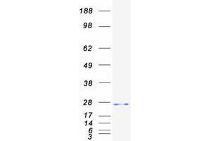 Western Blotting (WB) image for N-Acetyltransferase 8B (GCN5-Related, Putative, Gene/pseudogene) (NAT8B) protein (Myc-DYKDDDDK Tag) (ABIN2726852)