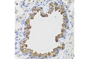 Immunohistochemistry of paraffin-embedded mouse lung using B9D1 antibody. (B9D1 抗体)
