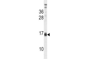 Western Blotting (WB) image for anti-Lactalbumin, alpha- (LALBA) antibody (ABIN2998275) (LALBA 抗体)