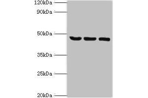 Western blot All lanes: SYT11 antibody at 14 μg/mL Lane 1: COLO205 whole cell lysate Lane 2: Mouse skeletal muscle tissue Lane 3: MCF-7 whole cell lysate Secondary Goat polyclonal to rabbit IgG at 1/10000 dilution Predicted band size: 48 kDa Observed band size: 48 kDa (SYT11 抗体  (AA 37-200))