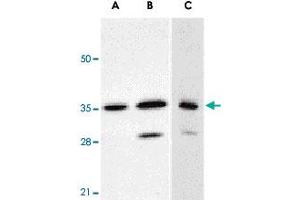 Western blot analysis of ANP32E expression in human A-549 (A) and HepG2 (B) cells, and rat testis (C) with ANP32E polyclonal antibody  at 1 ug/mL . (ANP32E 抗体  (C-Term))