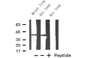Western blot analysis of Histone PDGFRL expression in various lysates (PDGFRL 抗体  (Internal Region))