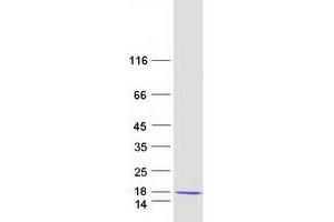 Western Blotting (WB) image for Late Endosomal/lysosomal Adaptor, MAPK and mTOR Activator 2 (LAMTOR2) (Transcript Variant 1) protein (Myc-DYKDDDDK Tag) (ABIN2712361)