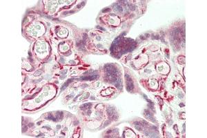 Formalin-fixed and paraffin-embedded H. (RECQL2 抗体  (AA 787-816))