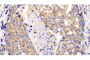 Immunohistochemistry (IHC) image for anti-Induced Myeloid Leukemia Cell Differentiation Protein Mcl-1 (MCL1) (AA 2-307) antibody (ABIN7440890)