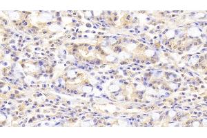 Immunohistochemistry (IHC) image for anti-phospholipase C, beta 3 (Phosphatidylinositol-Specific) (PLCB3) (AA 318-468) antibody (ABIN7444277)