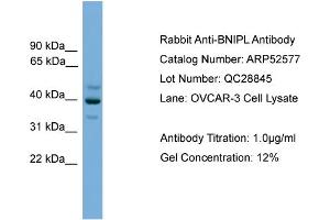 WB Suggested Anti-BNIPL  Antibody Titration: 0. (BNIPL 抗体  (Middle Region))