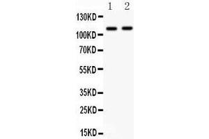 Western Blotting (WB) image for anti-Nucleotide-Binding Oligomerization Domain Containing 1 (NOD1) (AA 1-160) antibody (ABIN3043890) (NOD1 抗体  (AA 1-160))