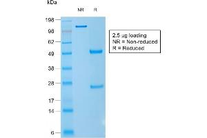SDS-PAGE Analysis Purified CD1a Mouse Recombinant Monoclonal Antibody (rC1A/711). (Recombinant CD1a 抗体)