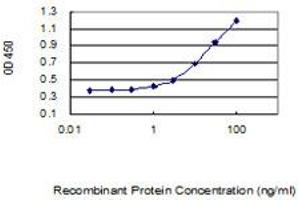 Detection limit for recombinant GST tagged KIAA1191 is 0. (KIAA1191 抗体  (AA 1-305))