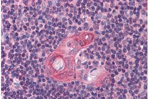Human Thymus: Formalin-Fixed, Paraffin-Embedded (FFPE) (BCL11B 抗体  (AA 395-444))