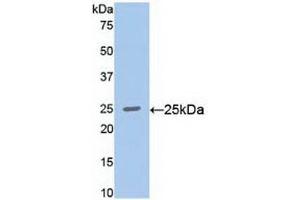 Detection of Recombinant RALA, Human using Polyclonal Antibody to V-Ral Simian Leukemia Viral Oncogene Homolog A (RALA) (rala 抗体  (AA 1-206))