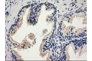 Image no. 5 for anti-Catalase (CAT) antibody (ABIN1497109)