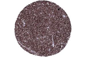 Immunohistochemistry (IHC) image for anti-Fc Fragment of IgE, Low Affinity II, Receptor For (CD23) (FCER2) (AA 48-321) antibody (ABIN7477405)