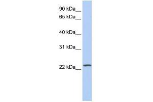 WB Suggested Anti-PIP5KL1 Antibody Titration: 0. (PIP5KL1 抗体  (Middle Region))