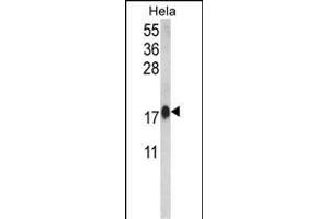 Western blot analysis of CALM1 Antibody (C-term) (ABIN652489 and ABIN2842329) in Hela cell line lysates (35 μg/lane). (Calmodulin 1 抗体  (C-Term))