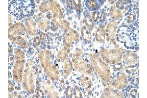PRMT1 antibody was used for immunohistochemistry at a concentration of 4-8 ug/ml to stain Epithelial cells of renal tubule (arrows) in Human Kidney. (PRMT1 抗体  (Middle Region))